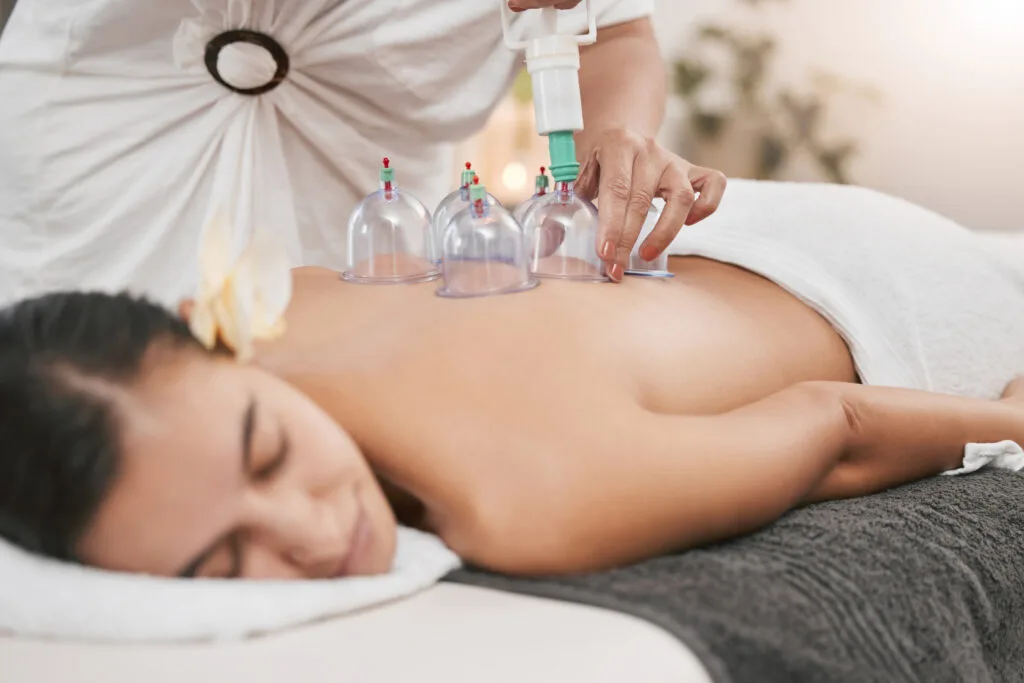 Cupping Massage